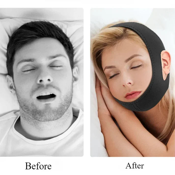 Anti-Snoring Chin Strap – Sleep Better, Breathe Easier, Live Happier!