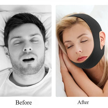 Anti-Snoring Chin Strap – Sleep Better, Breathe Easier, Live Happier!